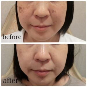 10月から２月は美のゴールデンシーズンです！！のアイキャッチ画像