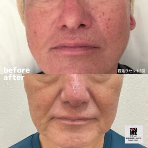 初めてのかたでも!のアイキャッチ画像